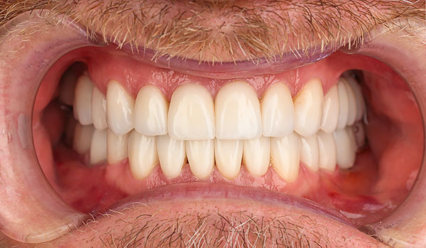 случай 1 после